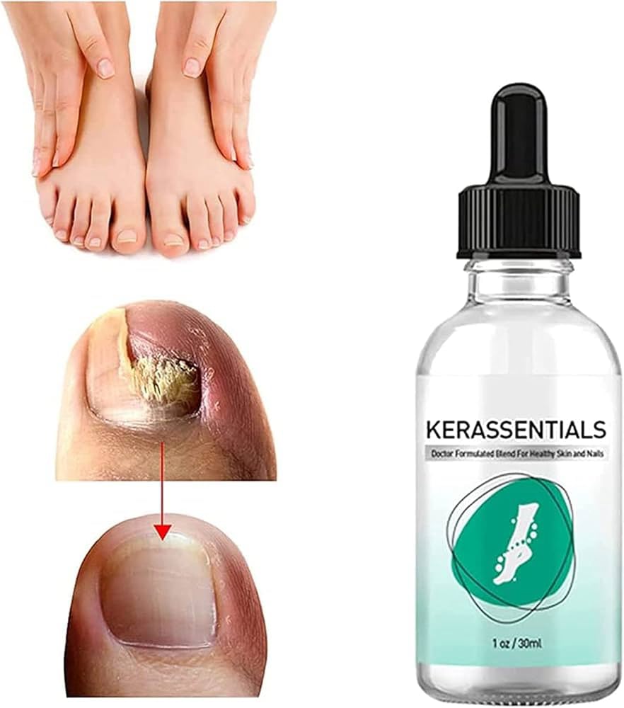 Kerassentials